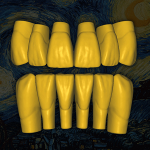 Biblioteca dental digital Old Van Gogh - Vista frontal con desgaste natural.