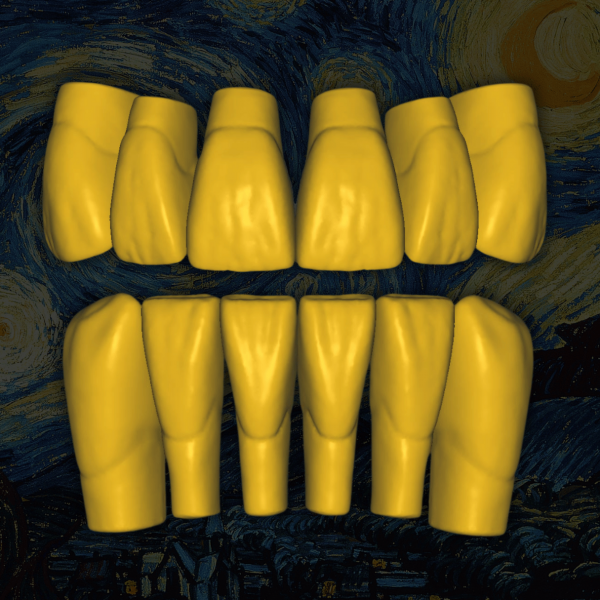 Biblioteca dental digital Old Van Gogh - Vista frontal con desgaste natural.