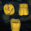 Restauración CAD/CAM en anatomía dental envejecida - Old Van Gogh.