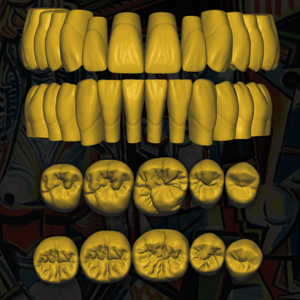 Diseño digital de dientes "Pablo Picasso" para laboratorios dentales.