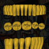 Diseño digital de dientes Pablo Picasso - Restauración STL en detalle.