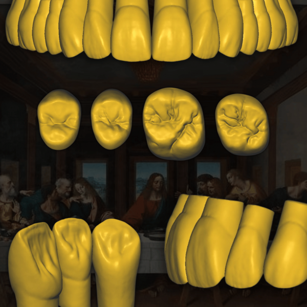 Escaneado 3D de anatomía dental con desgaste natural - Old Leonardo da Vinci.
