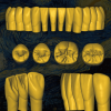 Archivo STL Van Gogh - Escaneado 3D dental optimizado.