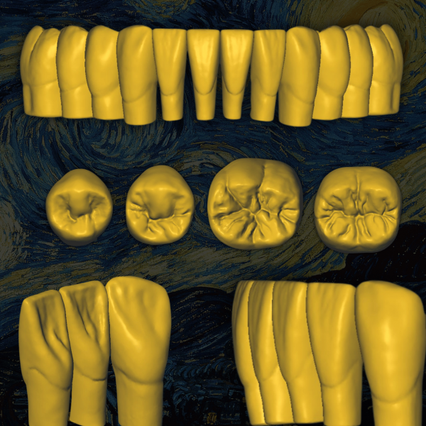 Archivo STL Van Gogh - Escaneado 3D dental optimizado.