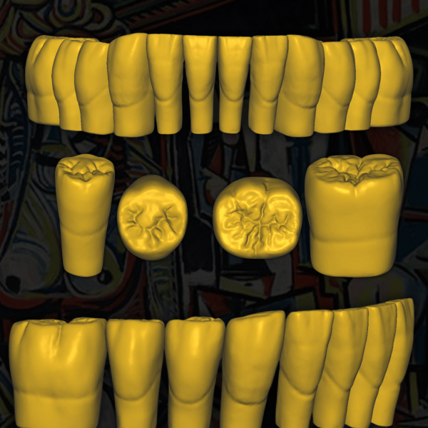 Dientes Digitales STL - Prótesis CAD/CAM para Laboratorios