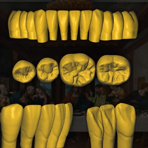 Biblioteca dental digital Leonardo da Vinci - Restauración STL en alta precisión.