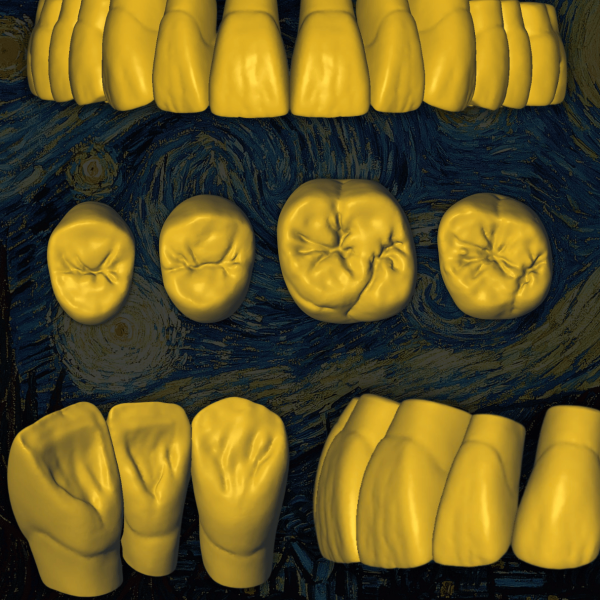 Diseño CAD de anatomía dental envejecida Old Van Gogh - Escaneo 3D.