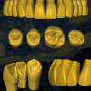 Biblioteca dental digital Van Gogh - Restauración STL con ajuste preciso.