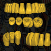 Escaneo Dental 3D - Modelos STL para Prótesis y Restauracione