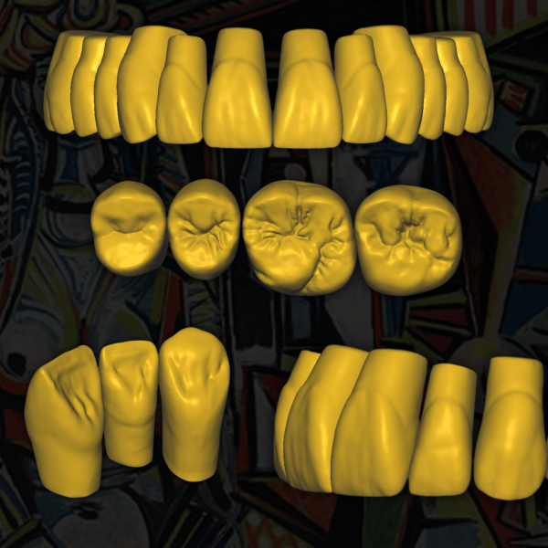 Escaneo Dental 3D - Modelos STL para Prótesis y Restauracione