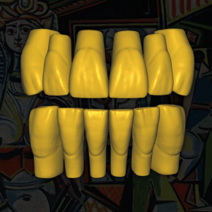 Prótesis CAD Dental - Diseño 3D de Alta Precisión