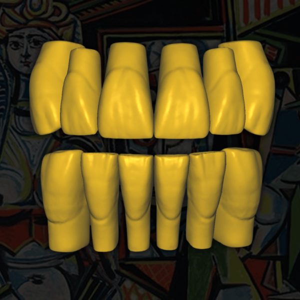 Prótesis CAD Dental - Diseño 3D de Alta Precisión