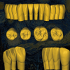 Escaneado 3D de anatomía dental con desgaste natural - Old Van Gogh.