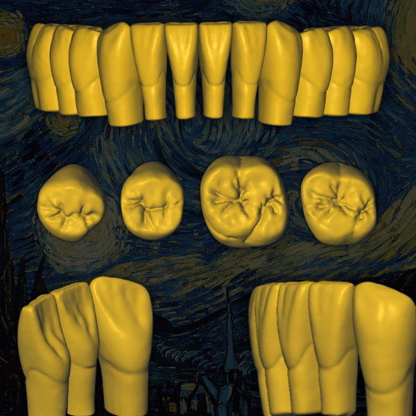 Escaneado 3D de anatomía dental con desgaste natural - Old Van Gogh.