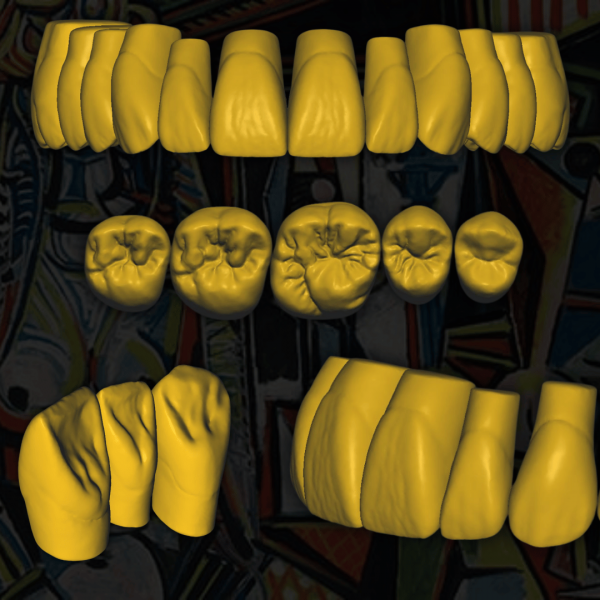 Escaneo Dental 3D - Modelos STL para Prótesis y Restauracione