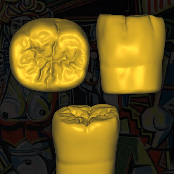Prótesis Dental STL - Modelos Digitales para Odontólogos
