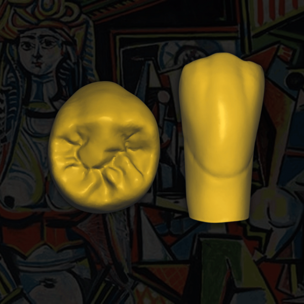 Set de dientes "Pablo Picasso" listo para carga en Exocad.