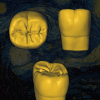 Detalle de desgaste en anatomía dental digitalizada - Old Van Gogh.