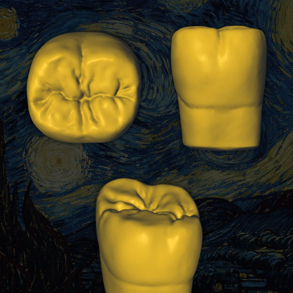 Detalle de desgaste en anatomía dental digitalizada - Old Van Gogh.