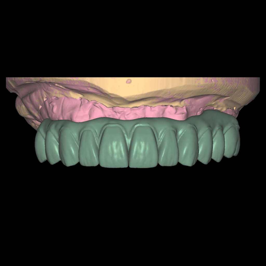 Libreria de dientes stl